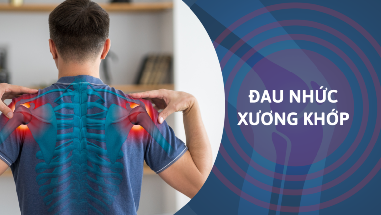 Đau nhức xương khớp