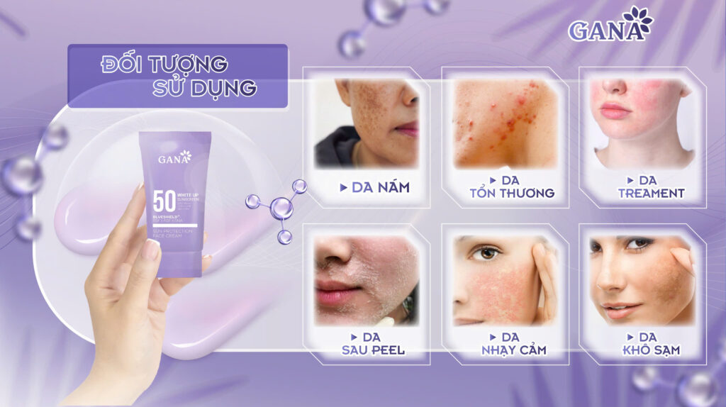 4. Sự Khác Biệt vượt trội của KCN 9 màng lcoj GANA
