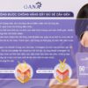KCN 9 màng lọc gana