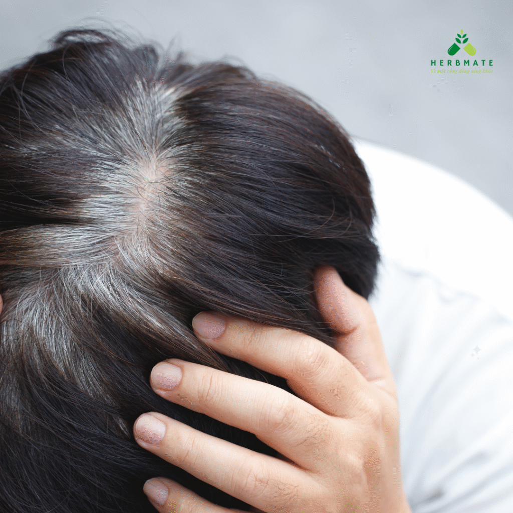 tóc bạc sớm