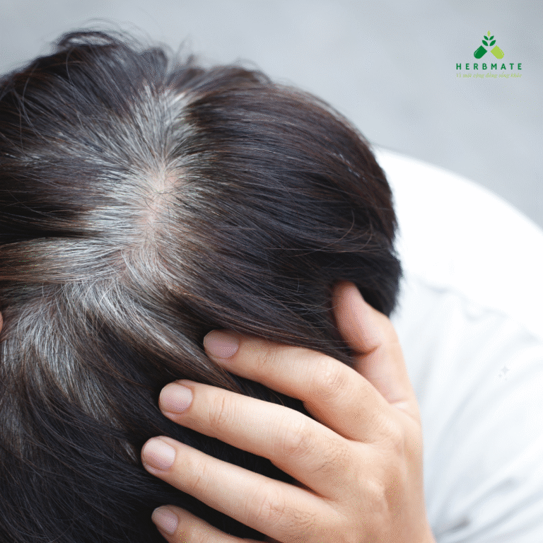 tóc bạc sớm