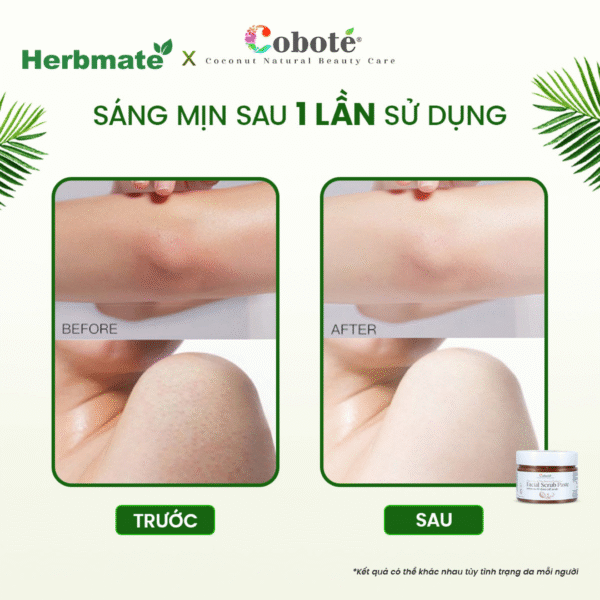 5 Đường Nâu Tẩy Tế Bào Chết Cơ thể Coboté 250g - Liệu Pháp Aromatherapy Cho Làn Da Mịn Mượt
